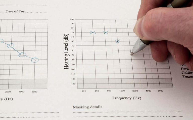 hearing-test-near-me